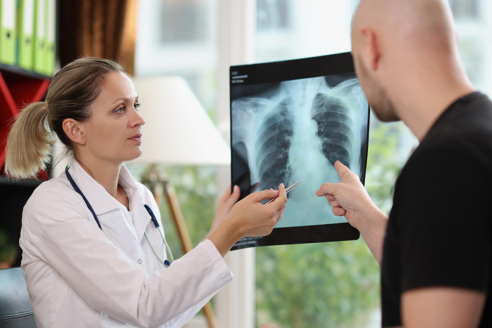Detectarea precoce a cancerului pulmonar